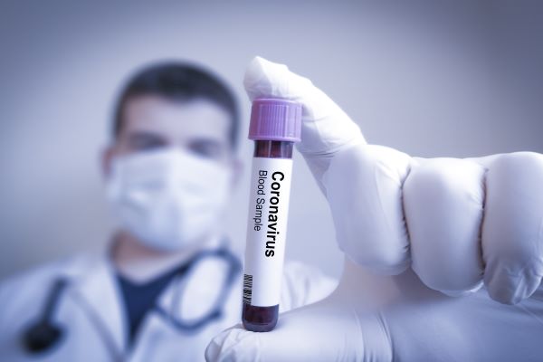 coronavirus-(covid-19)-:-reconfinement,-couvre-feu…-le-point-au-19-mars-2021