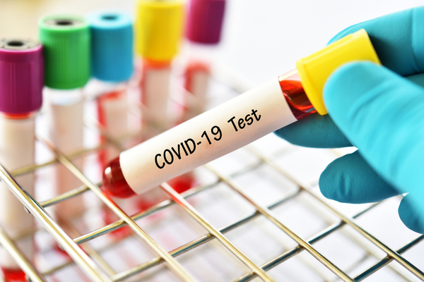 coronavirus-(covid-19)-:-combien-cela-coute-de-se-faire-tester-en-outre-mer-?