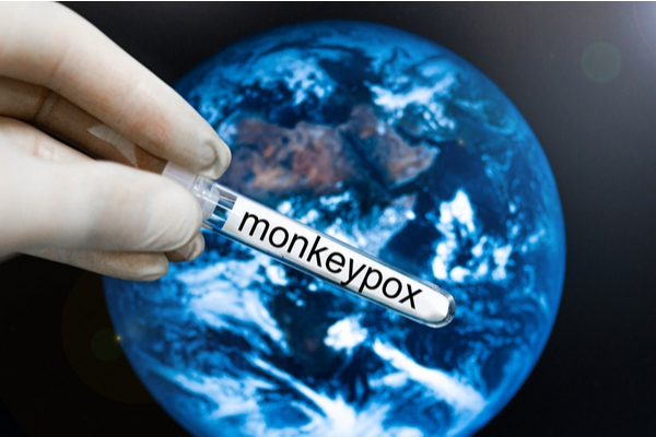 variole-du-singe-:-le-point-sur-la-campagne-de-vaccination